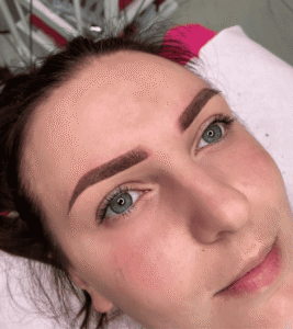 Woman with freshly tattooed eyebrows.