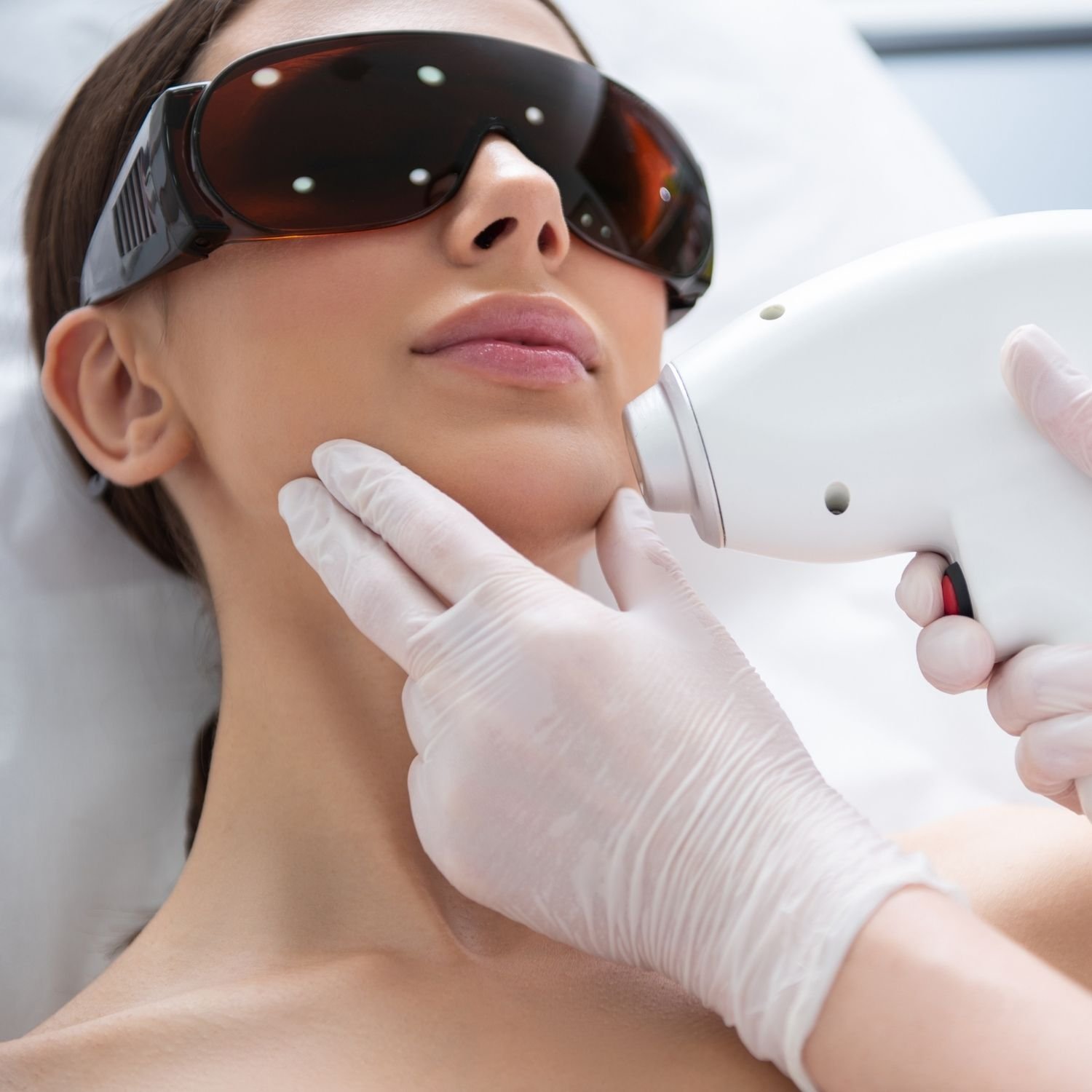 Woman receiving laser skin treatment with goggles.