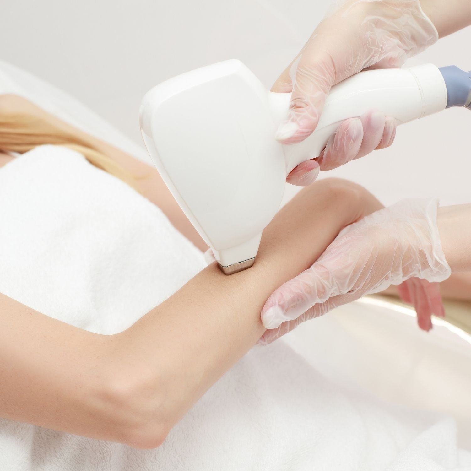 Laser hair removal on arm, close-up view.