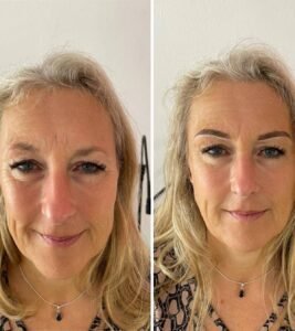 Before and after eyebrow transformation comparison.