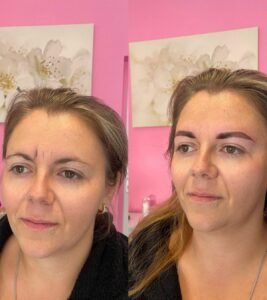Eyebrow transformation before and after microblading