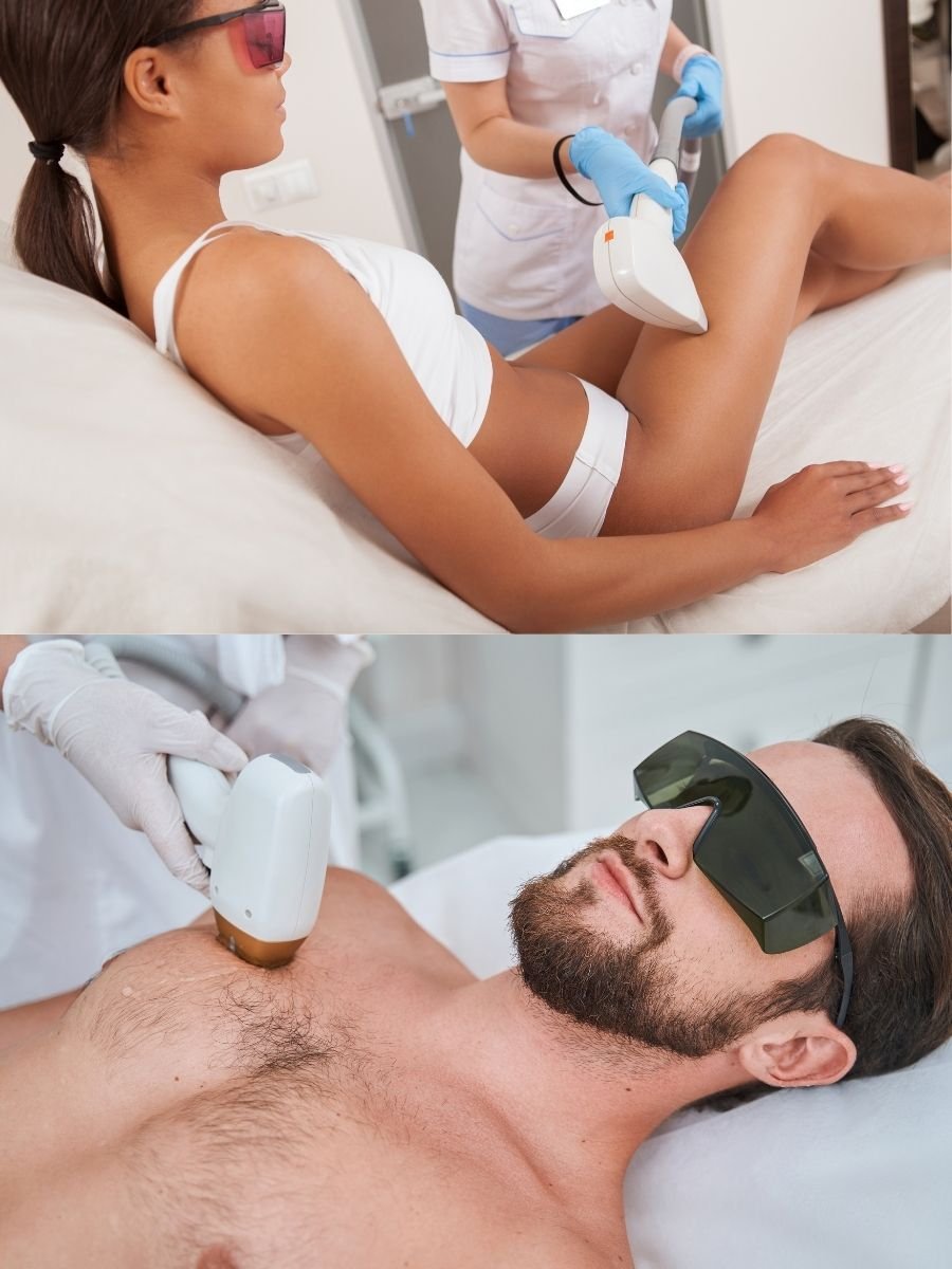 Laser hair removal treatment on legs and chest