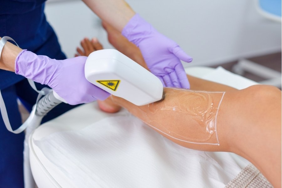 Leg receiving laser hair removal treatment.